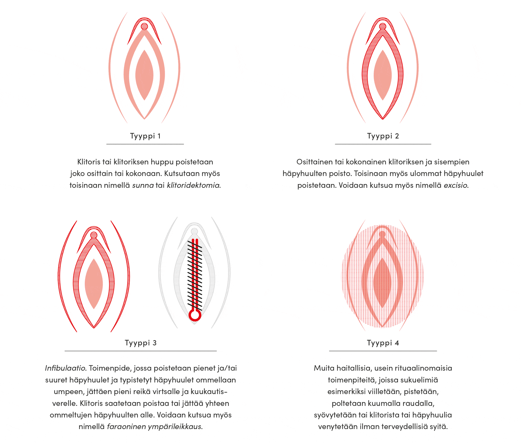 Neljä silpomistyyppiä esitelty visuaalisesti kuvituskuvien muodossa